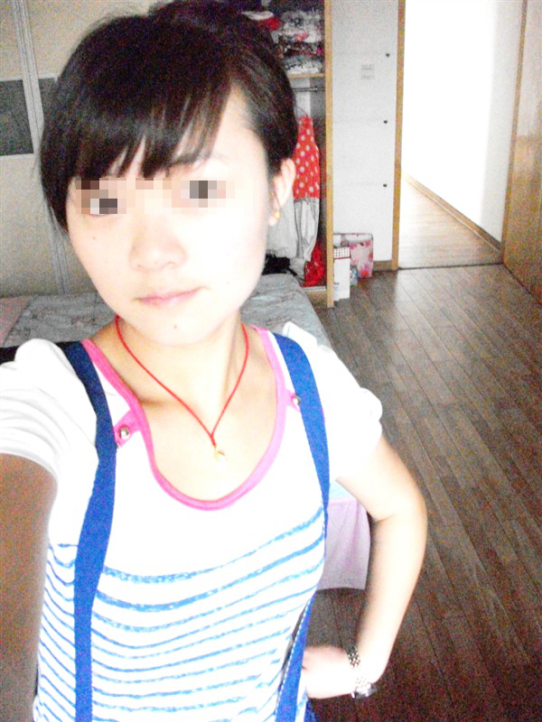 癫痫患者