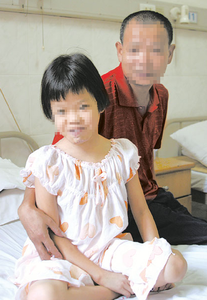 癫痫病患者