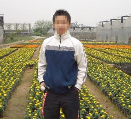 癫痫病患者