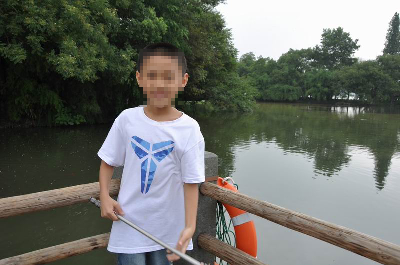 癫痫病患者