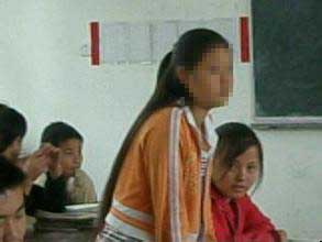 癫痫病患者