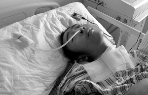 癫痫病患者