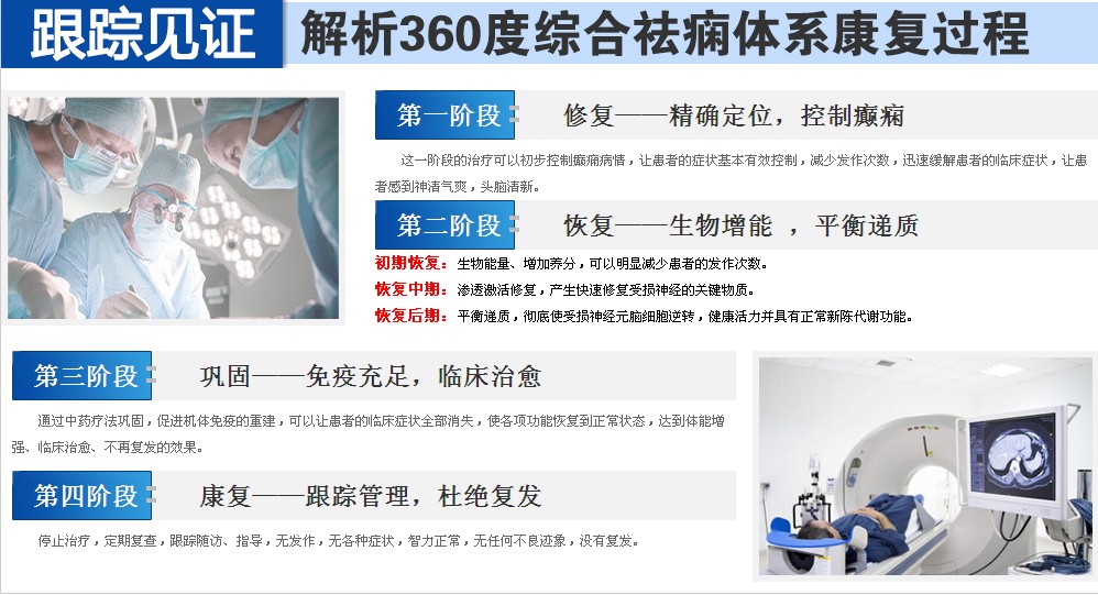 癫痫病的治疗技术