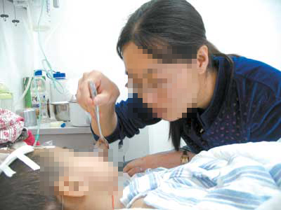 癫痫病患者